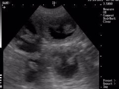 k9 pregnancy scanning